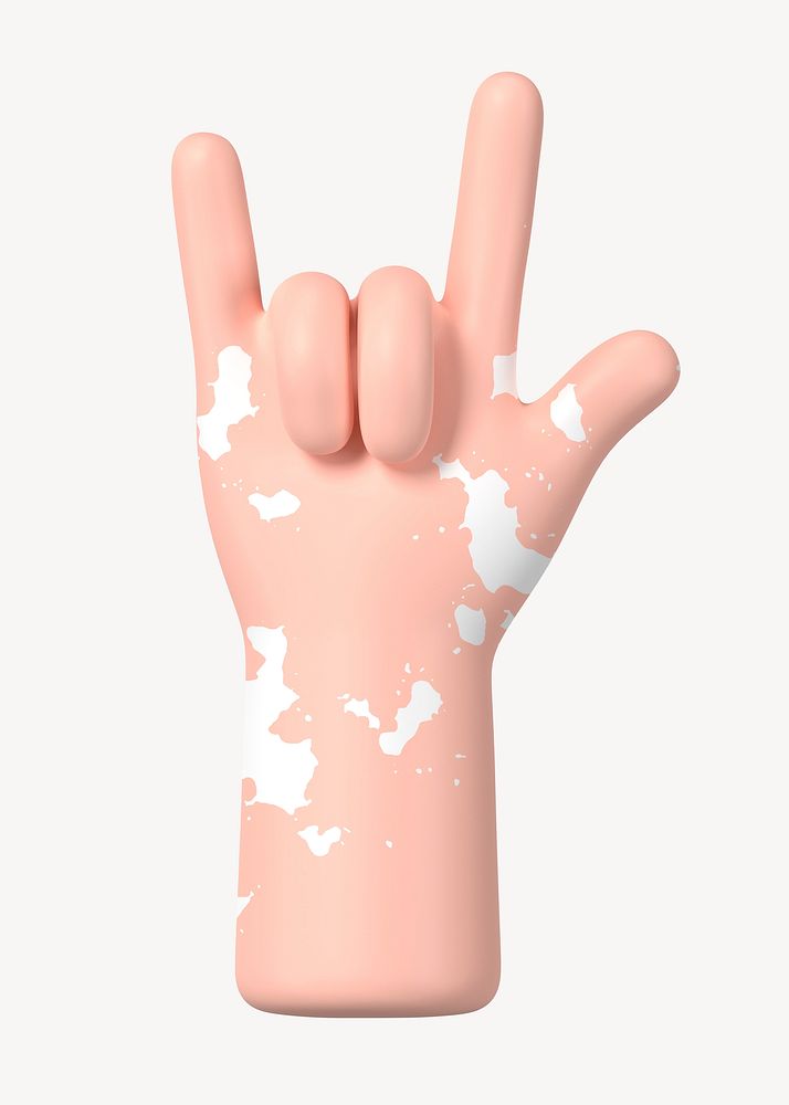 ILY vitiligo hand gesture, 3D love illustration