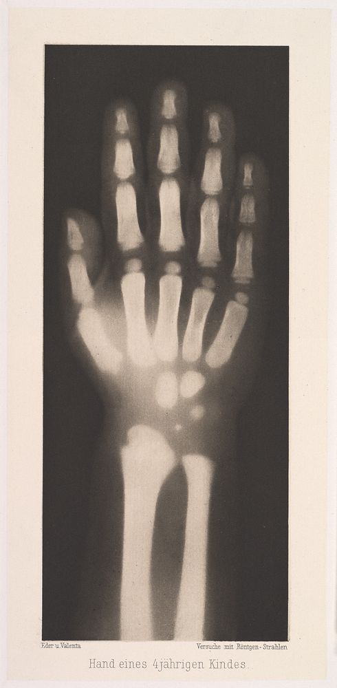 Photogravure; X-Ray; Photographs (1896) by Josef Maria Eder.