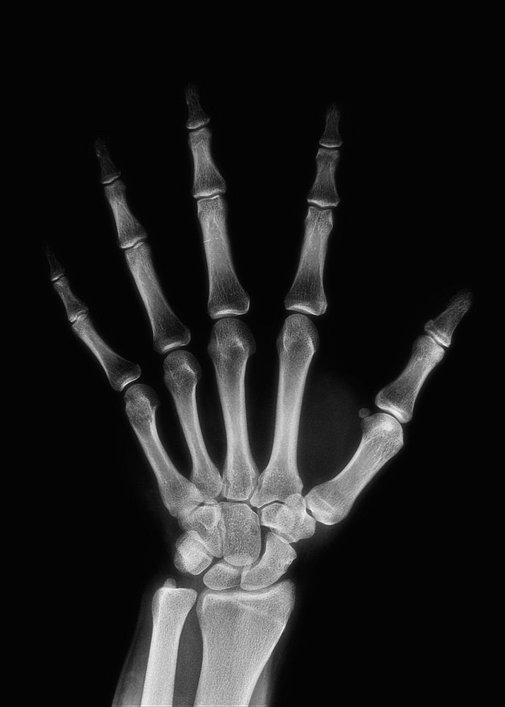 Hand CT scan isolated image