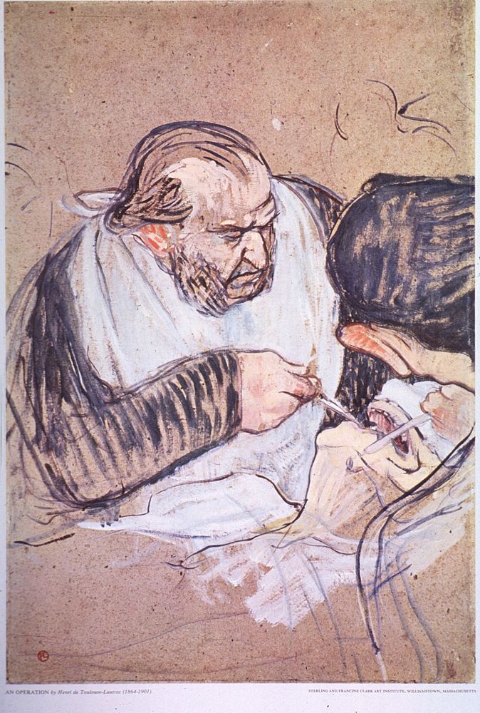 An OperationCollection:Images from the History of Medicine (IHM) Author(s):Toulouse-Lautrec, Henri de, 1864…