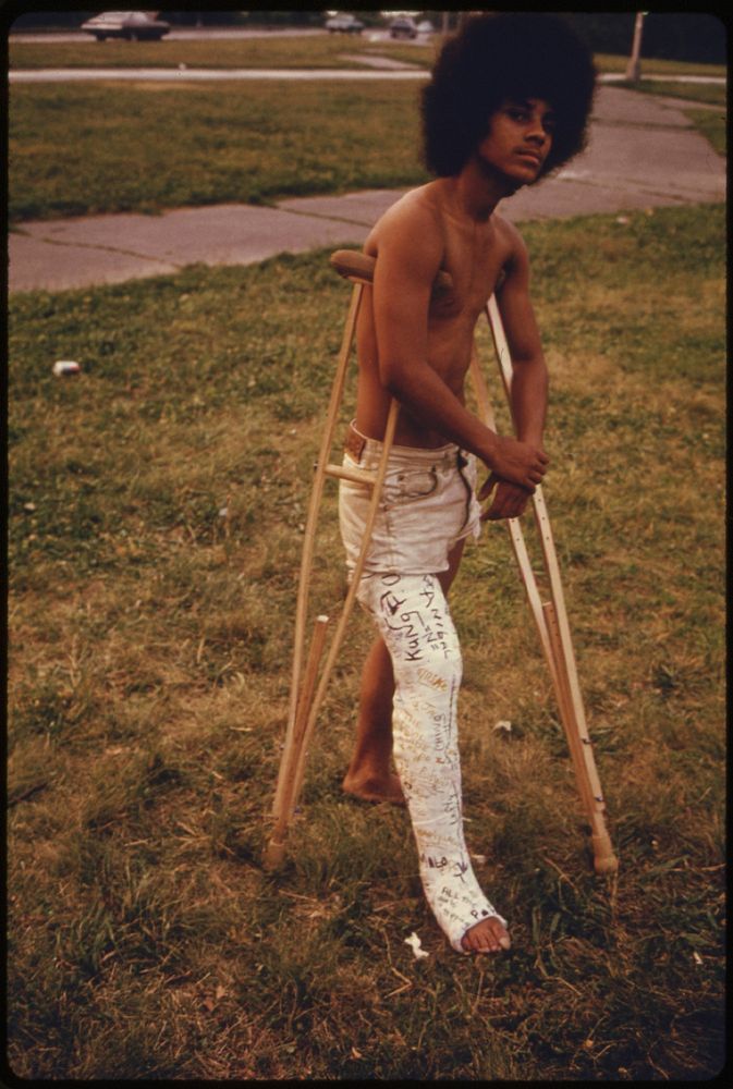 Young Man with His Leg in a Cast in Hiland Park of Brooklyn New York City. The Inner City Today Is an Absolute Contradiction…