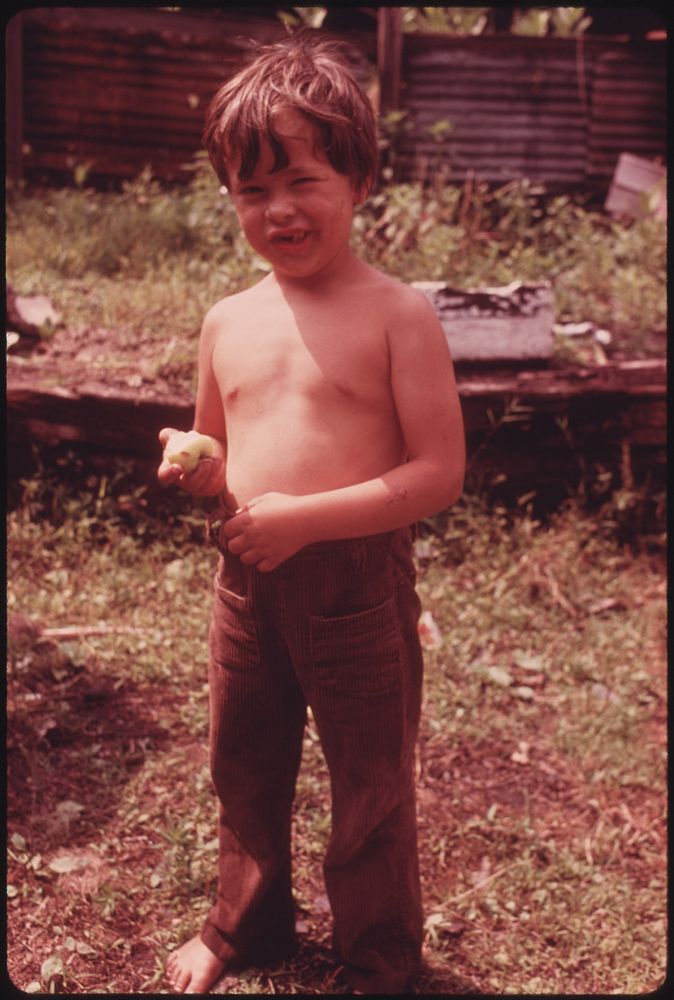 Gary Mckenny, 5, Son of a Miner, Eats a Green Apple in Rhodell West Virginia, near Beckley 06/1974. Photographer: Corn…