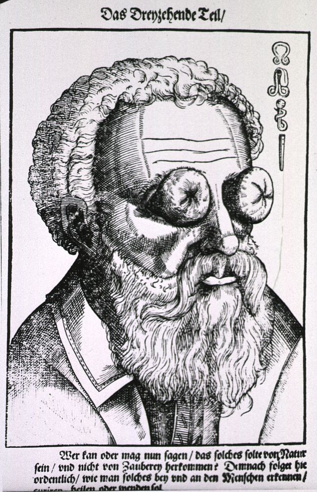 Fruit-like growths on the eyes. Close-up of the head of a man with large growths on his eyes; symbols in upper right corner…