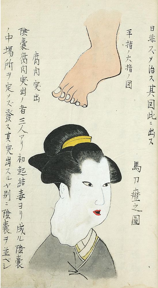 Hira yubi no mutsu yubi no zu. 2 images on one page. The top image shows a foot with 6 toes; the bottom one shows a woman…