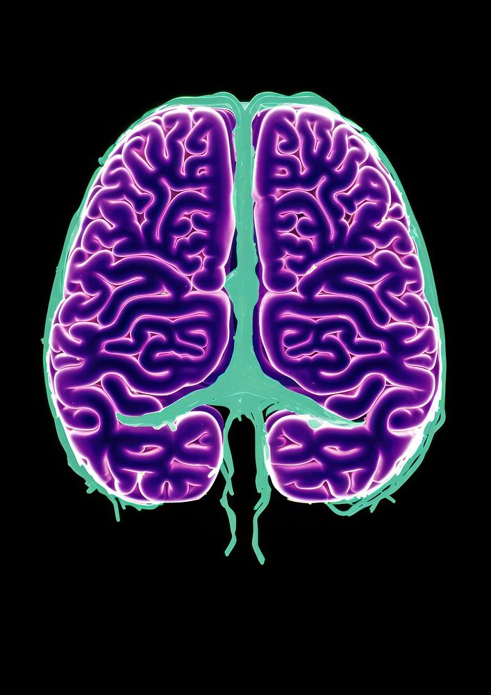 An mri brain scan purple black background tomography. AI generated Image by rawpixel.