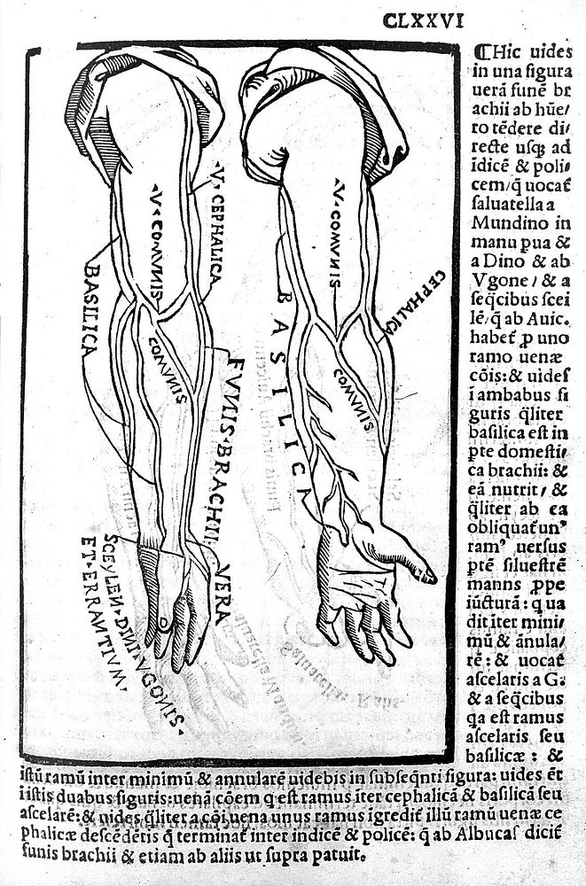 Carpi commentaria cũm amplissimis additionibus super Anatomia Mũndini vna cum textu eiusdẽm in pristinũm et verum nitorèm…