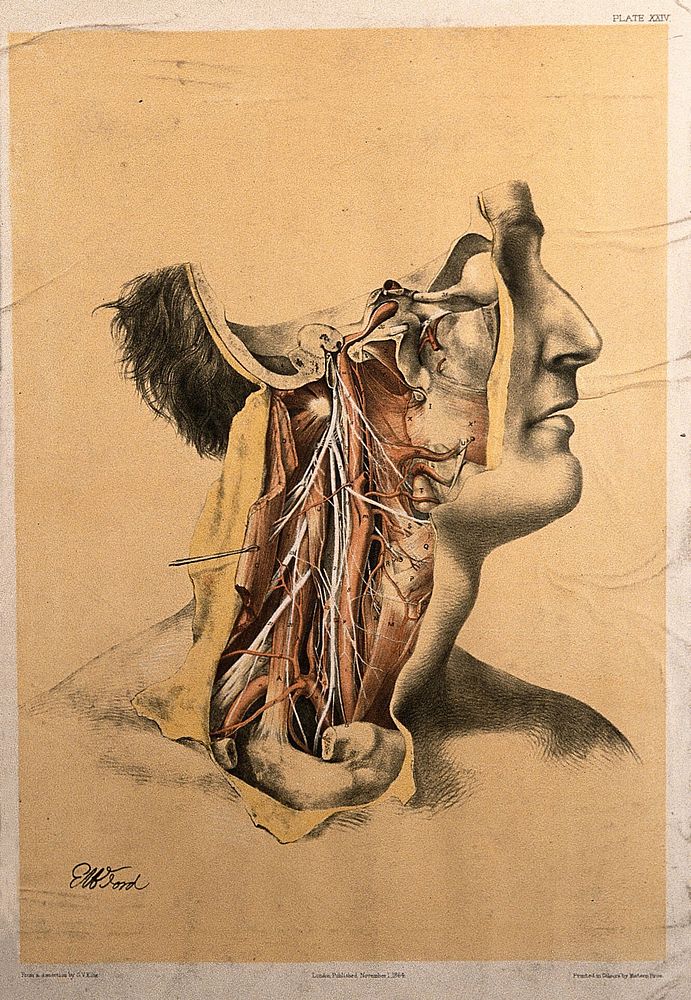 Dissection of the side of the face and neck, with the muscles and blood vessels indicated. Colour lithograph by G.H. Ford…