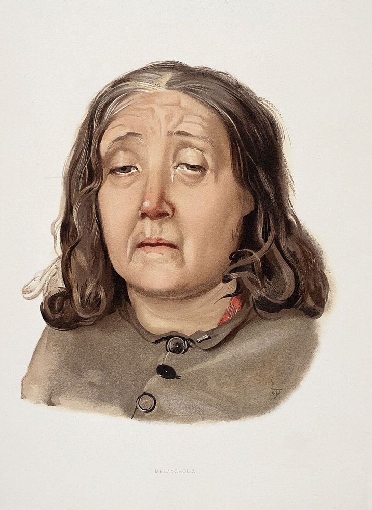 A woman diagnosed as suffering from melancholia. Colour lithograph, 1892, after J. Williamson, 1890.