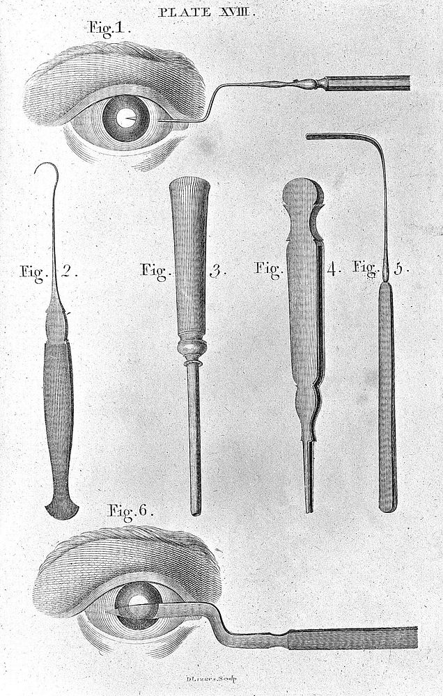 A system of surgery / By Benjamin Bell.