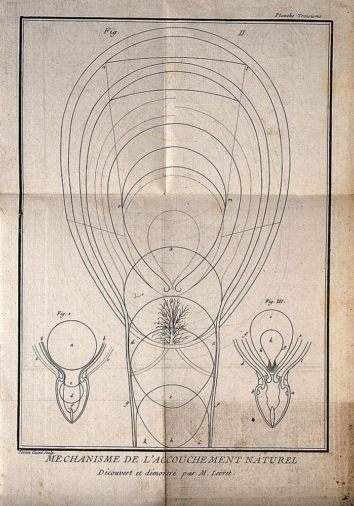 Three interior diagrams of an adult human uterus. Etching by G. Scotin.