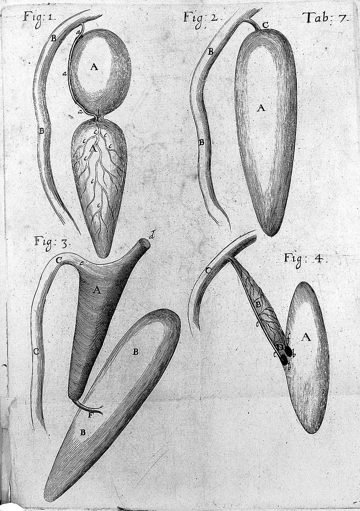 Disquisitio anatomica de formato foetu / Authore Gualtero Needham, M.D.