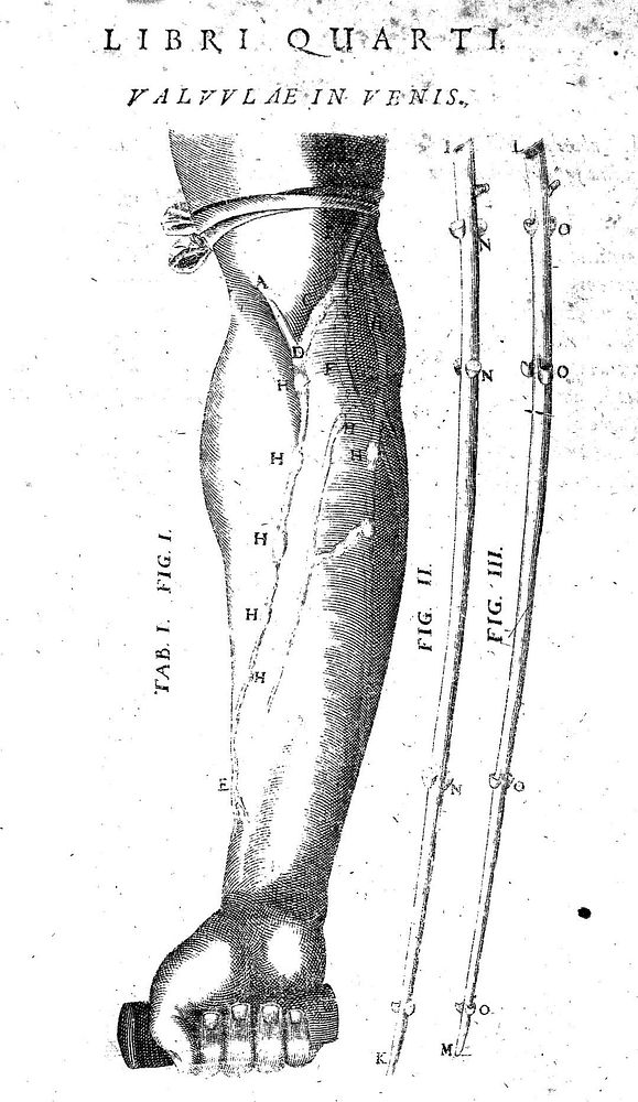Theatrum anatomicum Caspari Bauhini Basileen. Archiatri infinitis locis auctum, ad morbos accommodatum & ab erroribus ab…