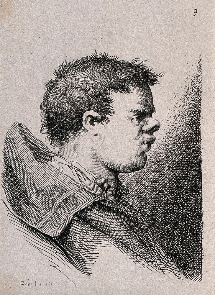 A young man in caricature, the features of his face bunched up into a small area. Engraving by B. Bossi, 1776, after himself.