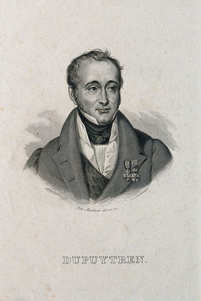 Guillaume, Baron Dupuytren. Line engraving by A. Martinet after himself.