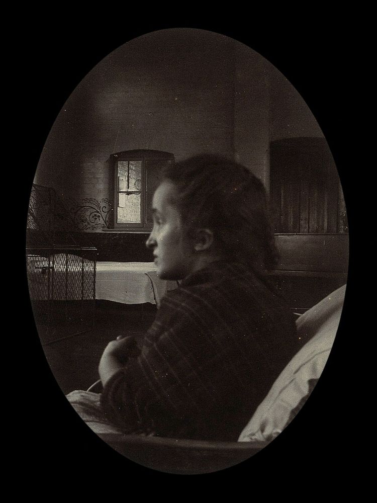 Side profile of a young woman with a misshapen head, wrapped in a tartan shawl, probably in a hospital. Photograph.