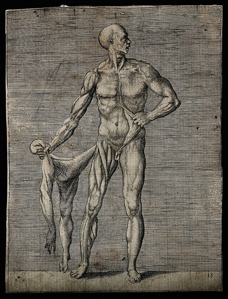 A male écorché figure, of whom only the right side of his body has been flayed. He holds the removed skin of his right side…
