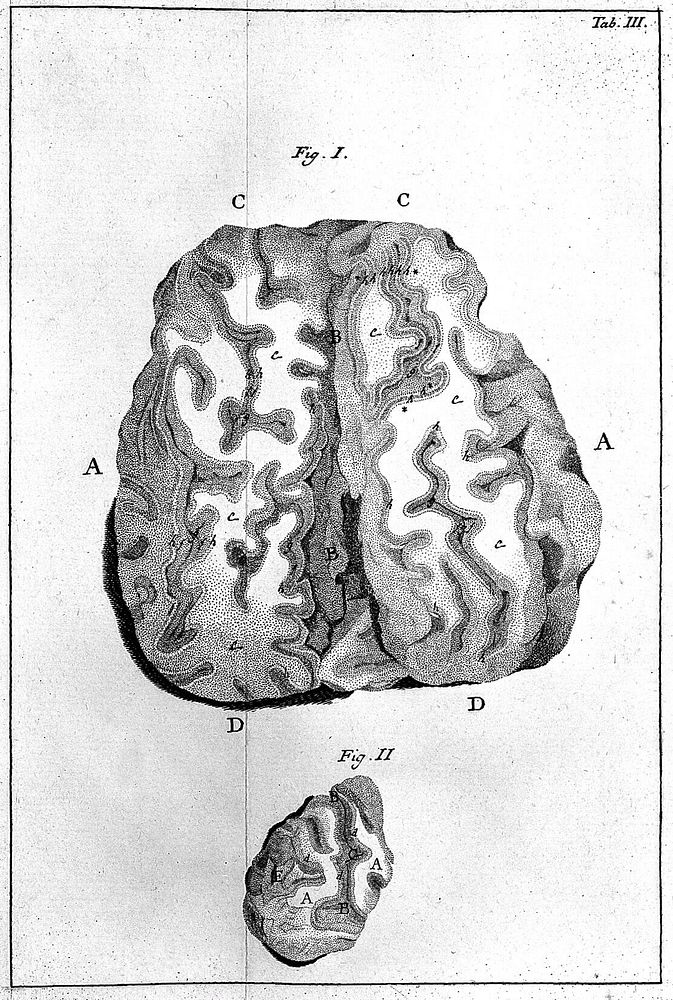 De peculiari structura cerebri nonnullisque ejus morbis ... Paucae aliae anatom. observat. accedunt / [Francisco Gennari].