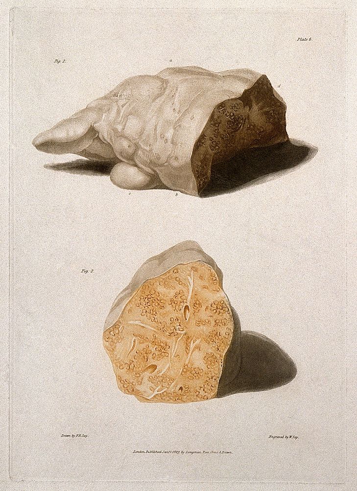 Two sections of diseased liver. Colour aquatint by W. Say after F. R. Say for Richard Bright, 1827.