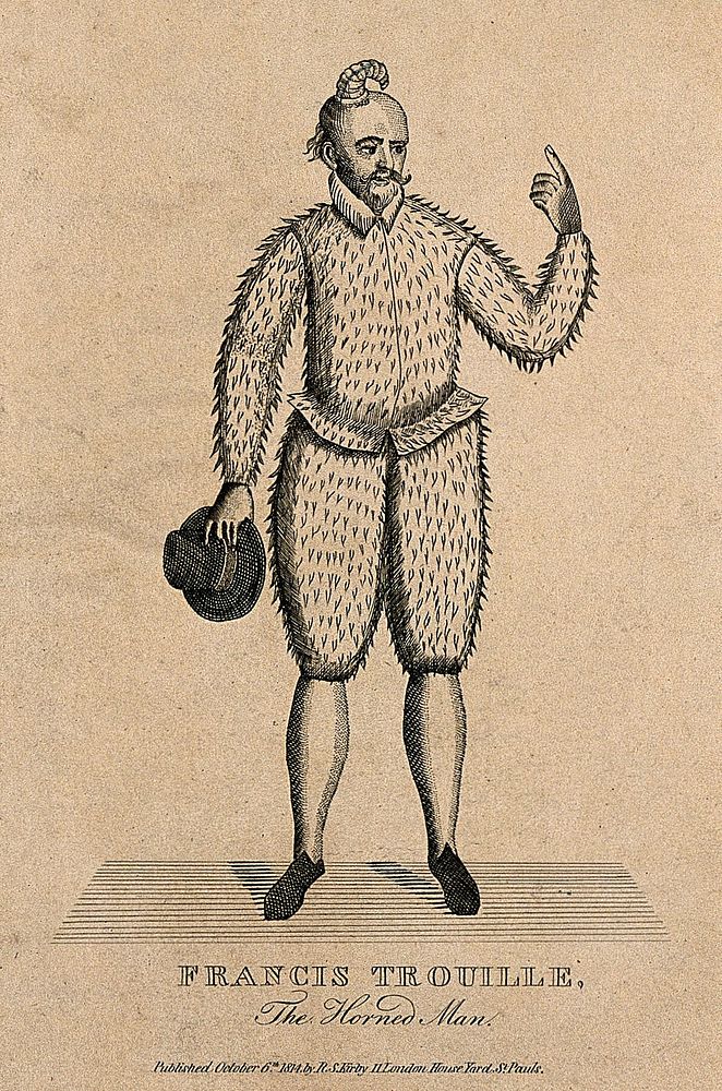 François Trouille, a man with a horn growing from his head. Etching, 1814.