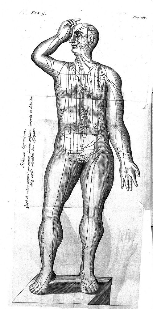 Transisalano-Daventriensis Dissertatio de arthritide: mantissa schematica: de acupunctura: et orationes tres, I. De chymiae…