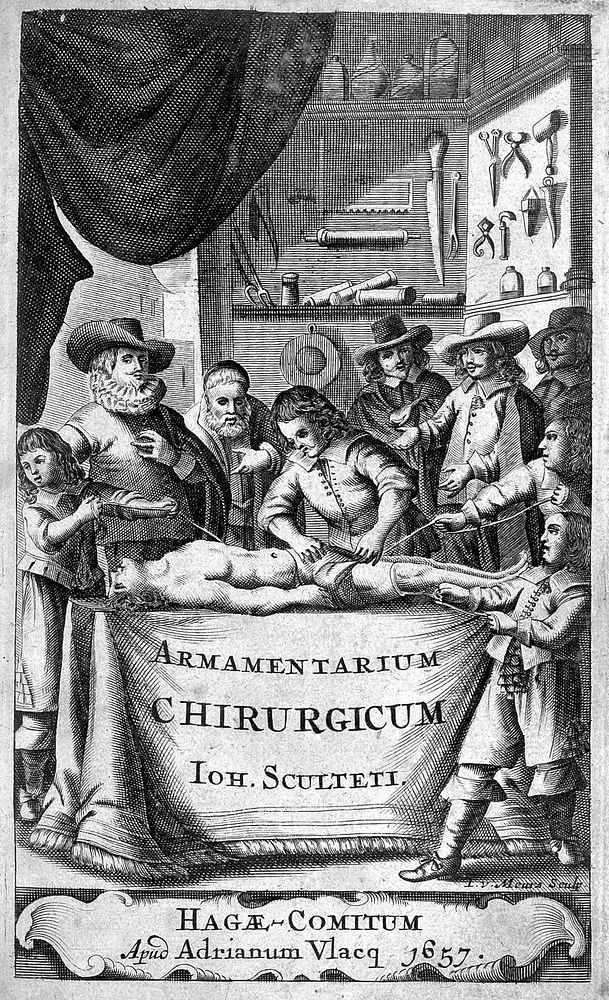J. Scultetus, Armamentarium Chirurgicum, 1657