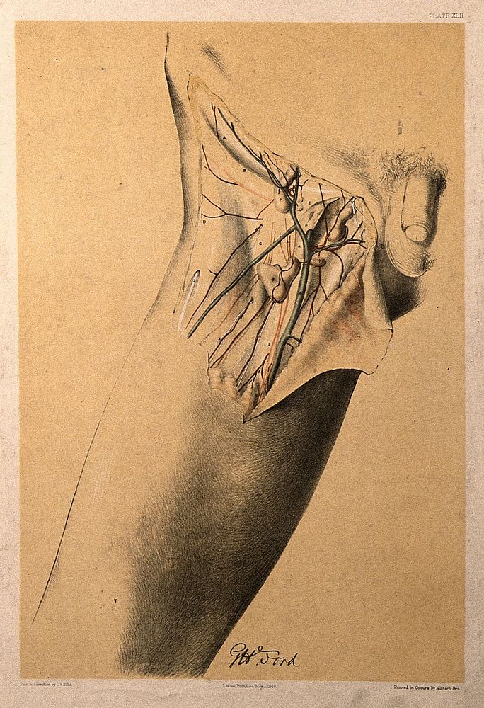 Dissection of the groin and upper thigh of a man, showing the blood vessels, veins and lymph nodes . Colour lithograph by…