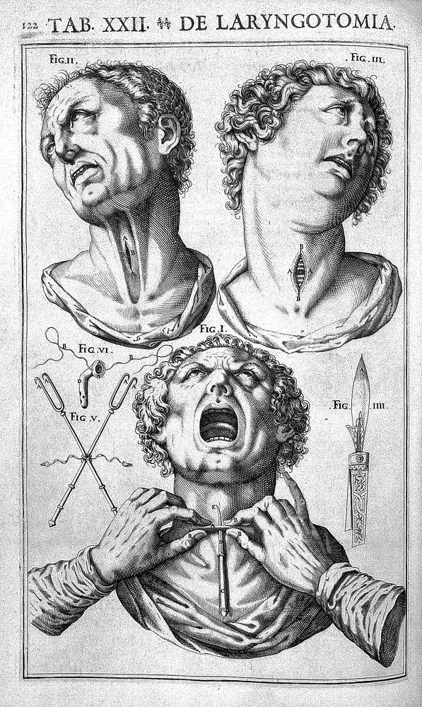 Julii Casserii Placentini ... De vocis auditusque organis historia anatomica singulari fide methodo ac industria concinnata…