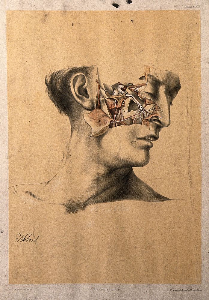Dissection of the side of the face, with the muscles and blood vessels indicated. Colour lithograph by G.H. Ford, 1864.