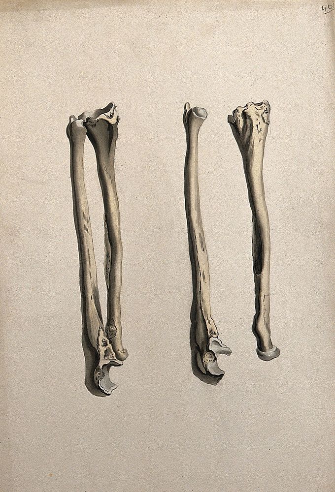 Radius and ulna bones: two figures. Ink and watercolour, 1830/1835, after W. Cheselden, ca. 1733.