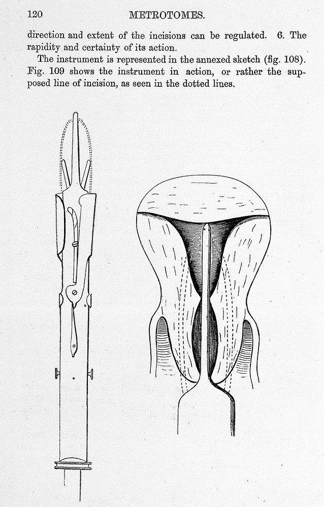 Catalogue and report of obstetrical and other instruments : exhibited at the Conversazione of the Obstetrical Society of…