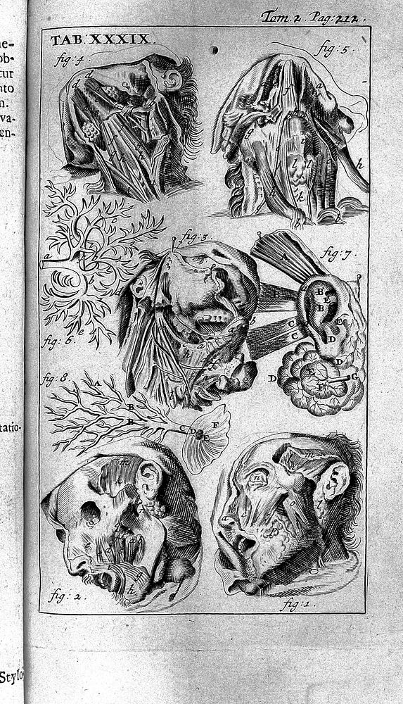 Anatomia reformata; sive concinna corporis humani dissectio, ad neotericorum mentem adornata, plurimisque tabulis…