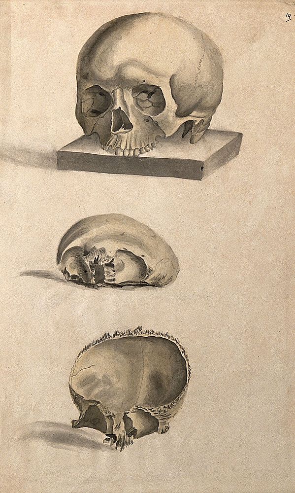 Human skull: three figures showing sections and an entire skull. Ink and watercolour, 1830/1835, after W. Cheselden, ca.…