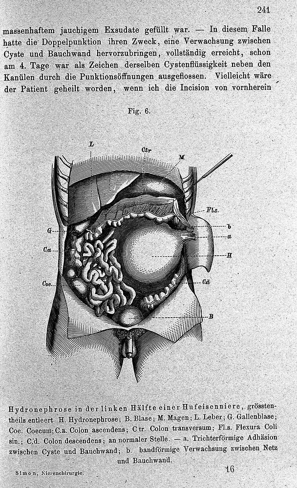 Chirurgie der Nieren / von Gustav Simon.