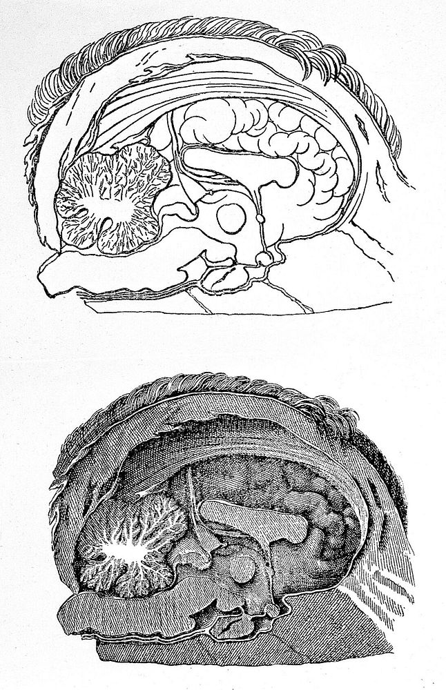 Sections of brain, sagittel and coronal.
