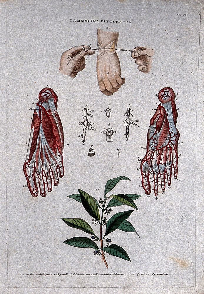 Top, surgery of the bones of the wrist; centre, arteries of the foot; bottom, the plant Ipecacuanha. Coloured engraving…