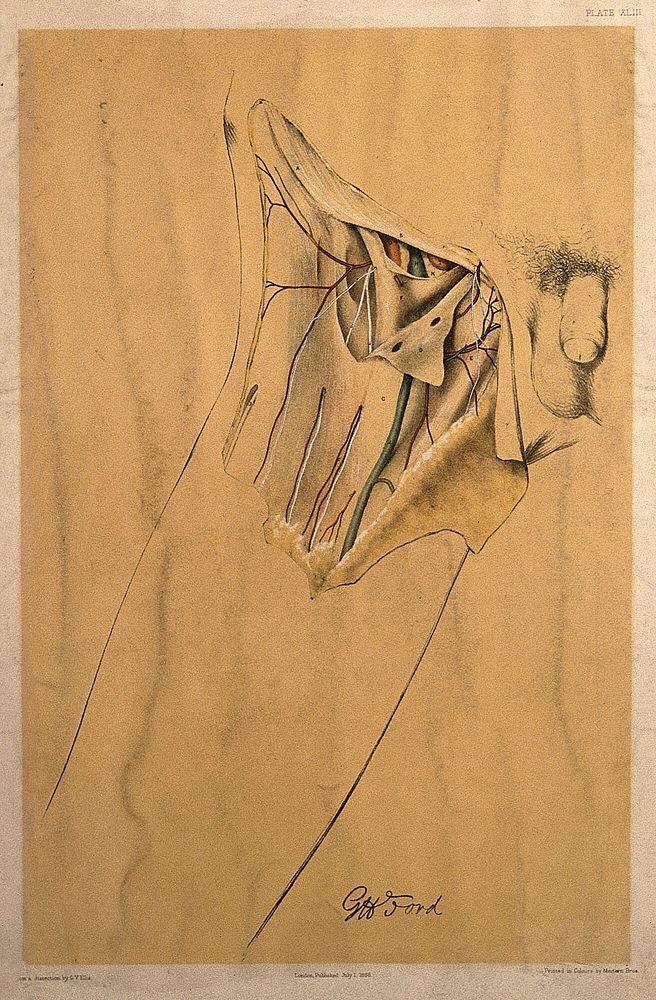 Dissection of the groin and upper thigh of a man, showing the blood vessels and veins. Colour lithograph by G.H. Ford, 1866.