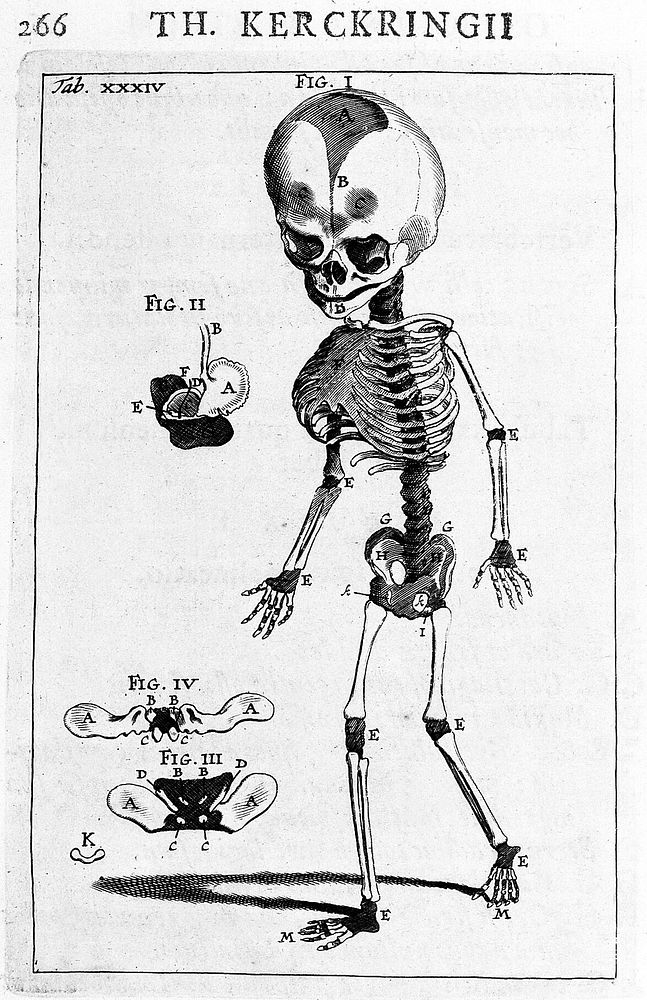 Theodori Kerckringii, doctoris medici, Opera omnia anatomica; continentia Spicilegivm anatomicvm, Osteogeniam foetvvm: nec…