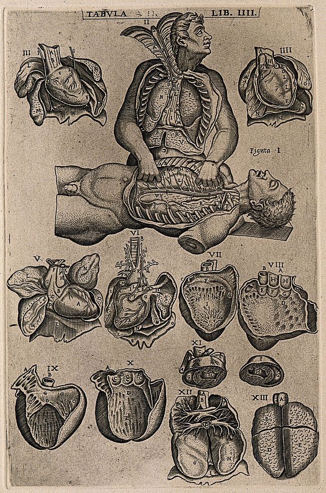 Two figures with their thoracic cavity exposed, one dissecting the other (figs I-II), together with illustrations mainly of…