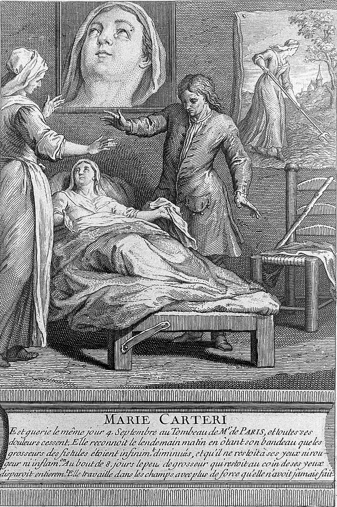 Marie Carteri convalescing after being cured from fistula lacrimal as a consequence of visiting the tomb of F. de Paris.…
