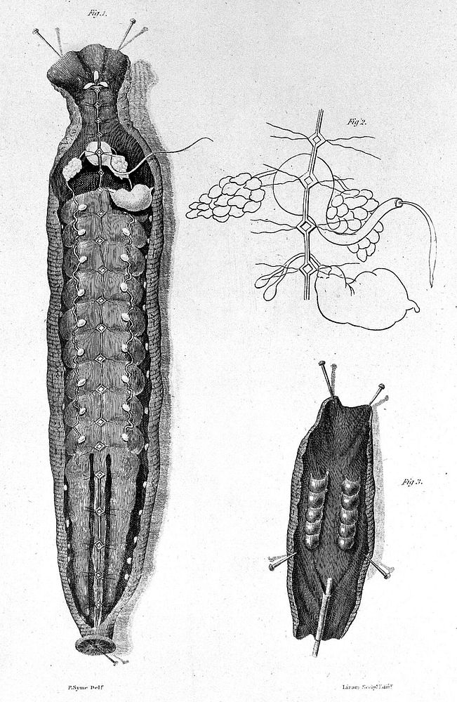 A treatise on the medicinal leech; including its medical and natural history, with a description of its anatomical…