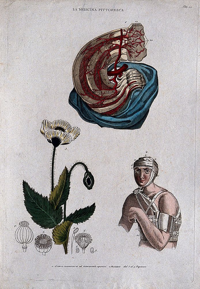 Anatomy, nursing and botany; top, arteries of the breast; bottom left, poppy; bottom right, man with bandaged head and arm.…