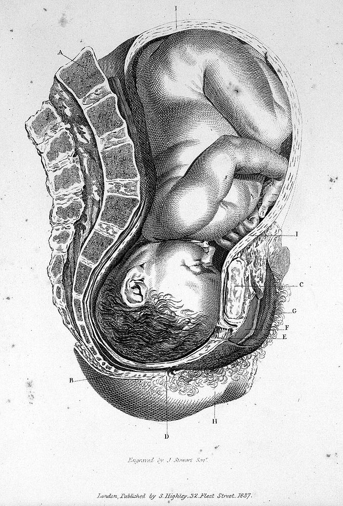 Obstetric plates, with explanations / selected from the anatomical tables of William Smellie.