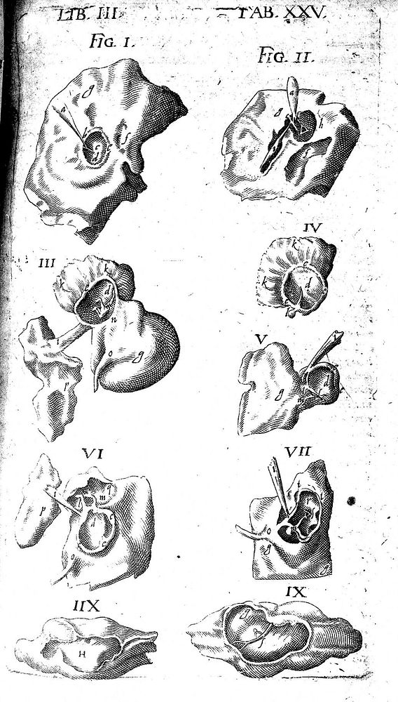Theatrum anatomicum / novis figuris aeneis illustratum, et in lucem emissum opera et sumptibus Theodori de Bry.