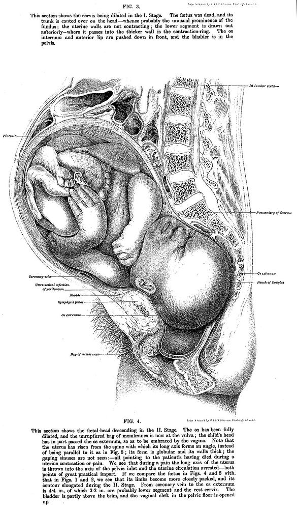 The anatomy of labour : including that of full-time pregnancy and the first days of the puerperium exhibited in frozen…