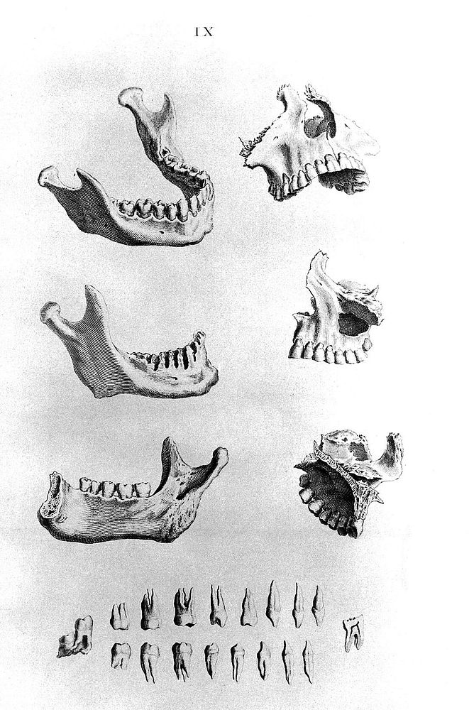 W. Cheselden, "Osteographia", 1733 - teeth