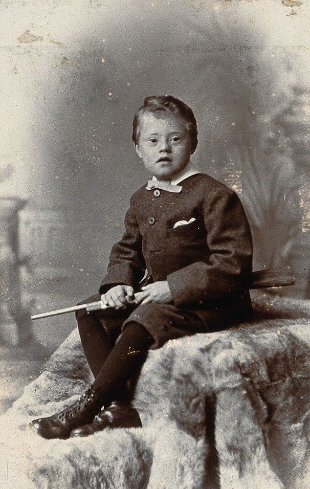 A boy with Down's syndrome, holding a rifle and sitting on a fur carpet. Photograph by R.W. Morris.