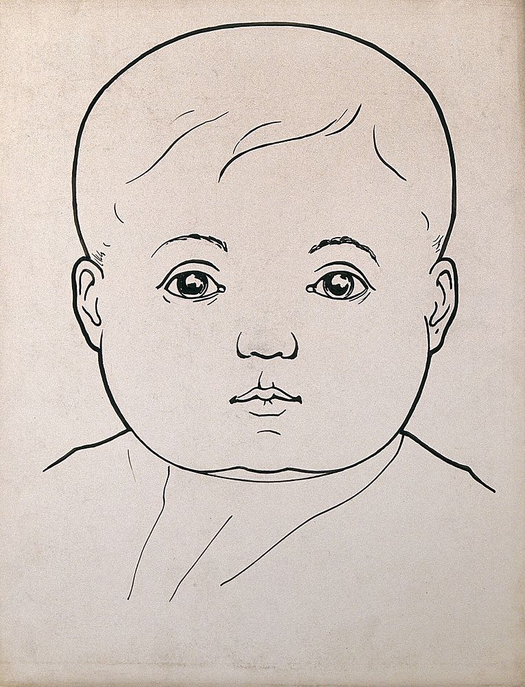 Head of a child with large cheeks. Drawing, c. 1900.