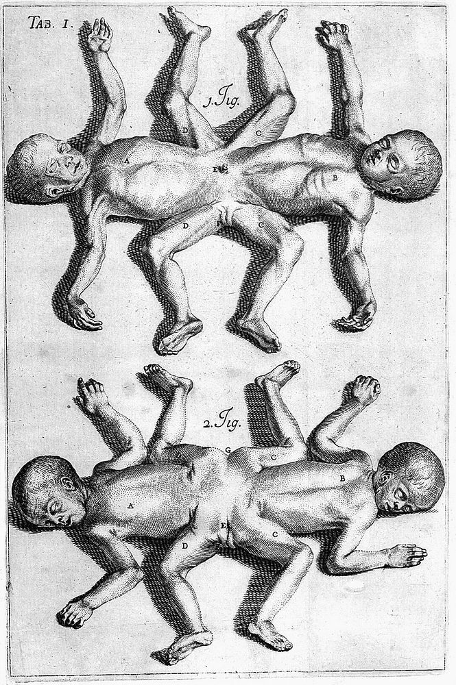 Description anatomique des parties de la femme, qui servent à la generation; avec un Traité des monstres [by F. Licetus], de…