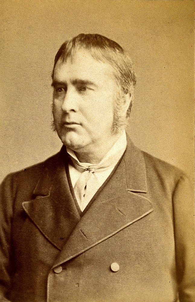 Sir William Withey Gull. Photograph.