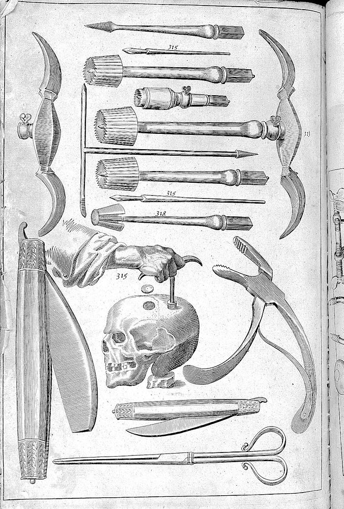 The surgeons mate, or, Military & domestique surgery : discovering ... ye method and order of ye surgeons chest, ye uses of…